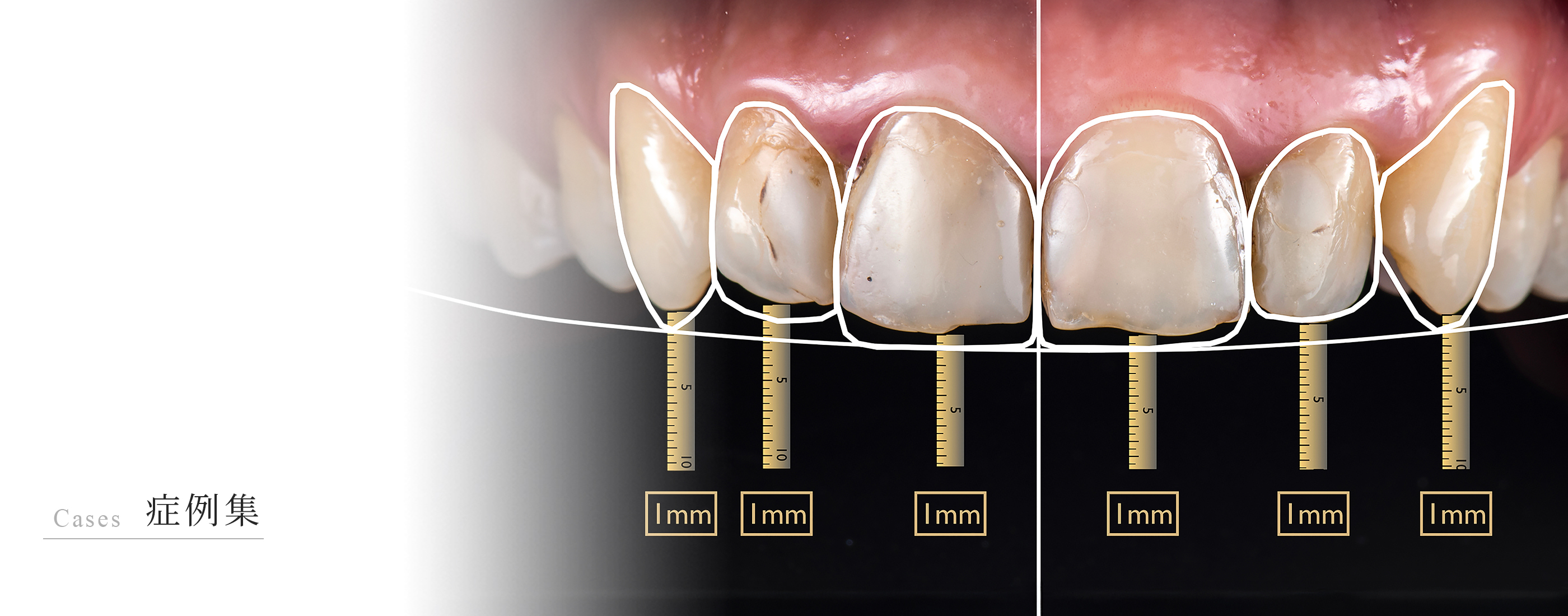 キービジュアル