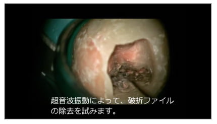 2.破折ファイルの除去