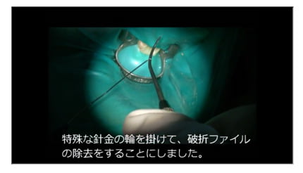 3.特殊な針金の輪をかける