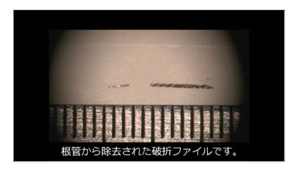 5.破折ファイルを除去