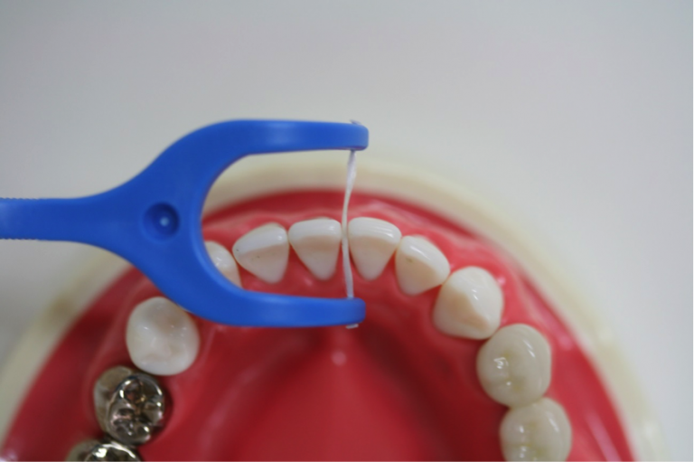 糸を歯と歯の間に入れる角度