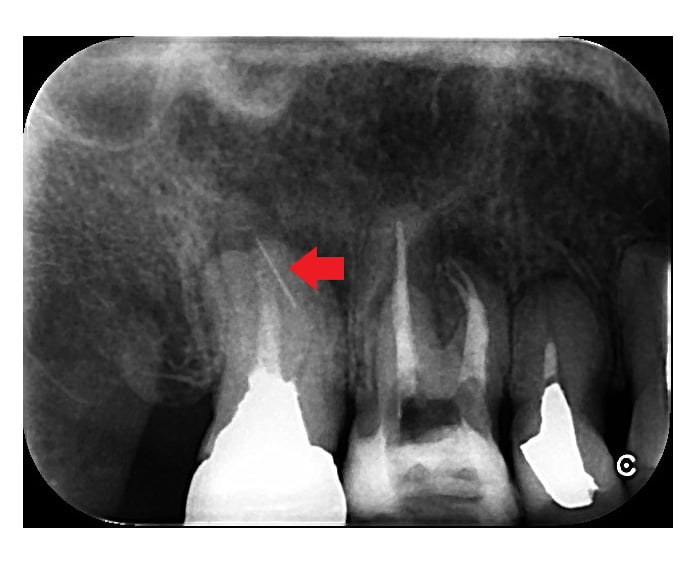 レントゲン画像