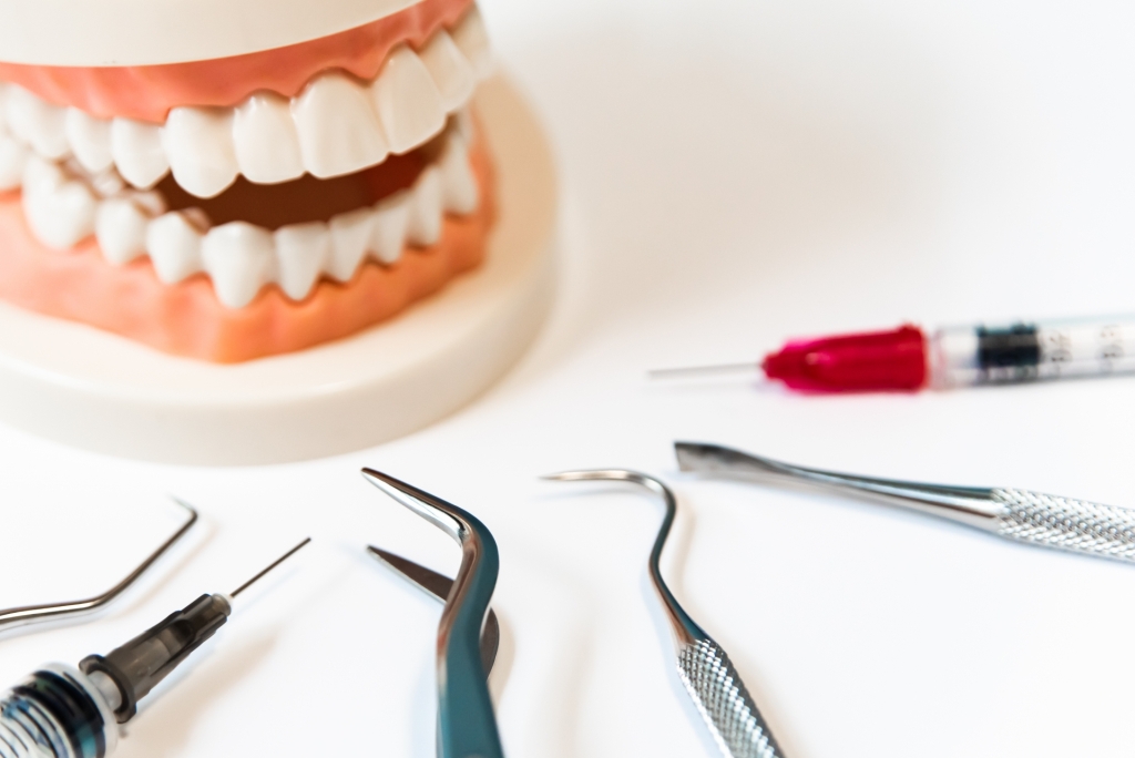 むし歯の治療をした歯が、何故またむし歯になって抜歯になってしまう？後悔しないための、むし歯治療とは。