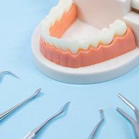 根管治療をしても治らず歯根端切除術を行ったが再発してしまった… 歯根尖切除術を含む外科的歯内療法の予後について。