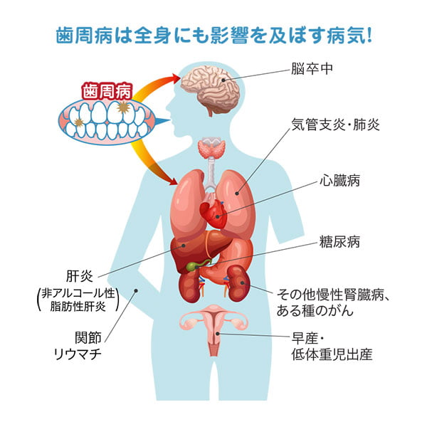 口腔常在菌が全身疾患に及ぼす影響