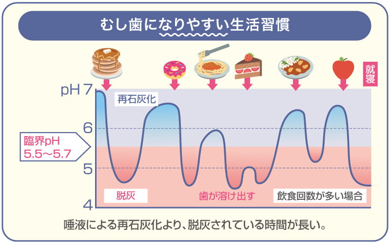 むし歯になりやすい