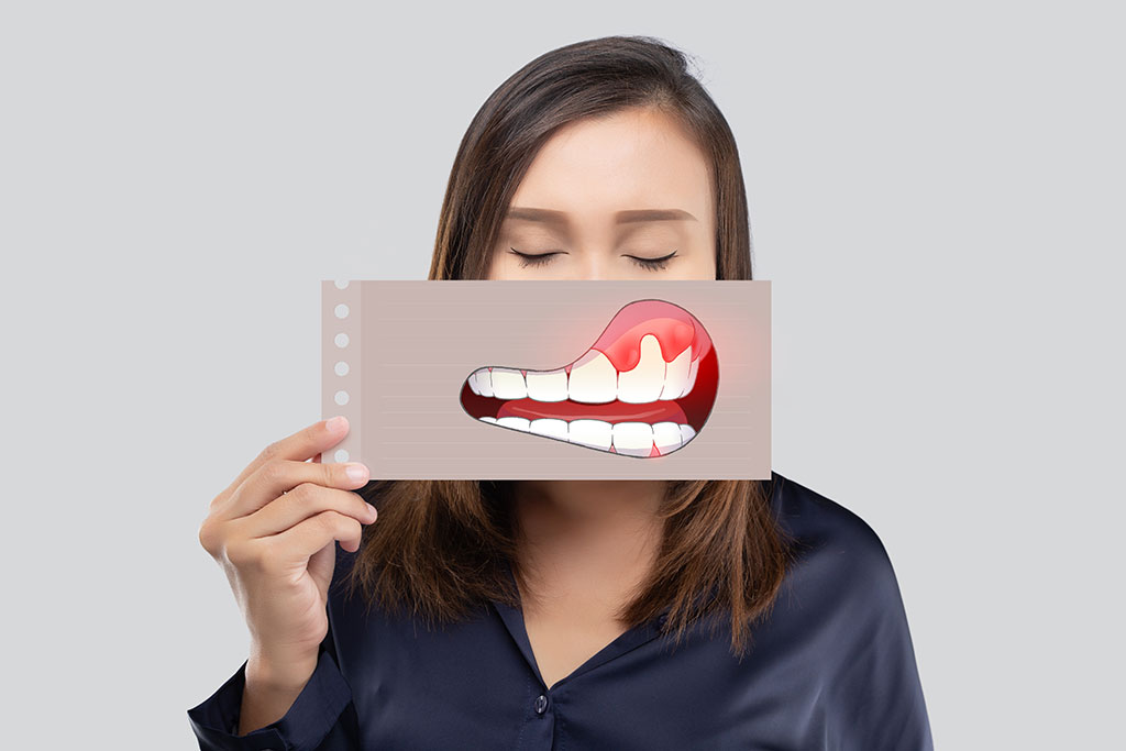 静かに忍び寄る歯周病への対処法！３つのポイント